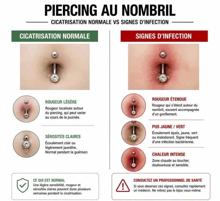 Infographie montrant les différences entre une cicatrisation normale et une infection de piercing au nombril